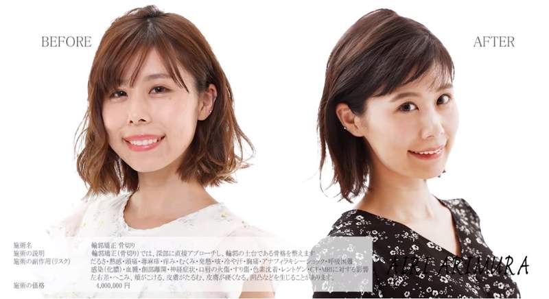 圖片14 圖片14